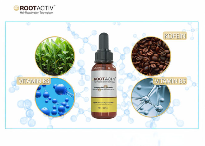 root active 658x470
