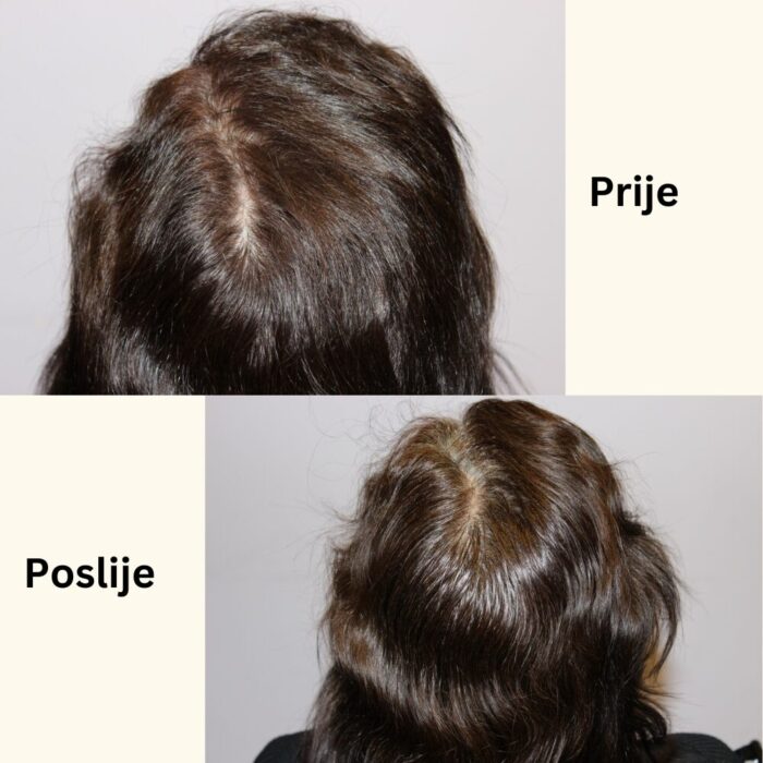 RootActive5 (2)